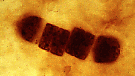 Cyanobacteria Cells - click on figure for reference page.